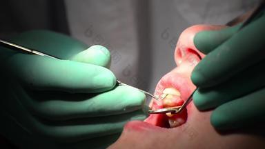 牙医牙齿检查